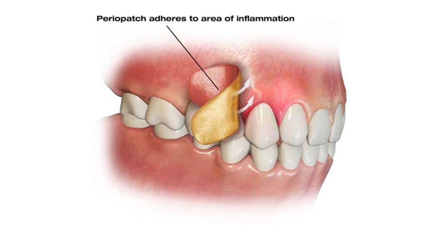 Fig 4 copy alternate text for this image
