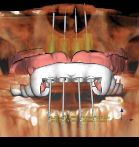 Birdi FIGURE3 alternate text for this image