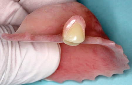 Bronstein fig 8A alternate text for this image