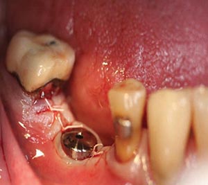 Doniger 5 alternate text for this image