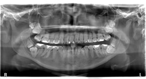 Fig 1 alternate text for this image