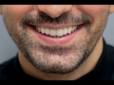 photos YN alternate text for this image