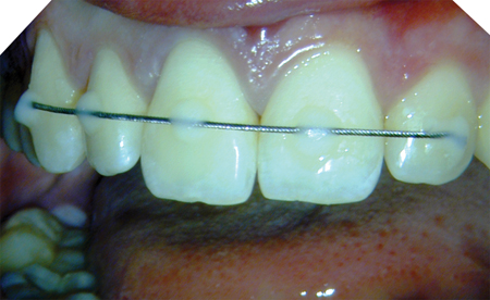 Nahmias figure 2 alternate text for this image