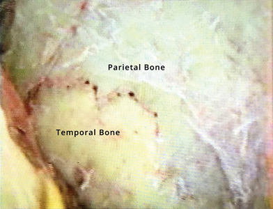 Williams Figure 3 alternate text for this image