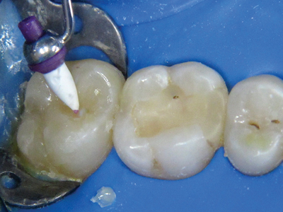 Marangos 8. Optrasculpt alternate text for this image