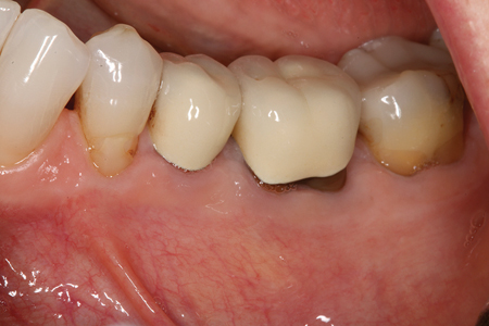 Nahmias1-Fig 14 alternate text for this image