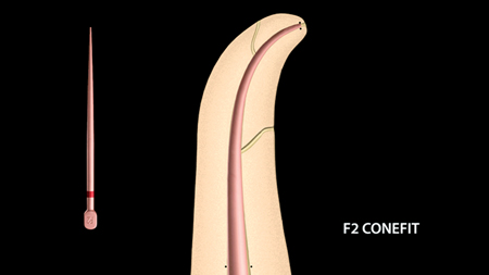 West Figure 1C alternate text for this image