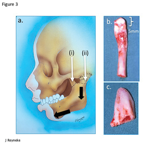 Reyneke fig3 alternate text for this image