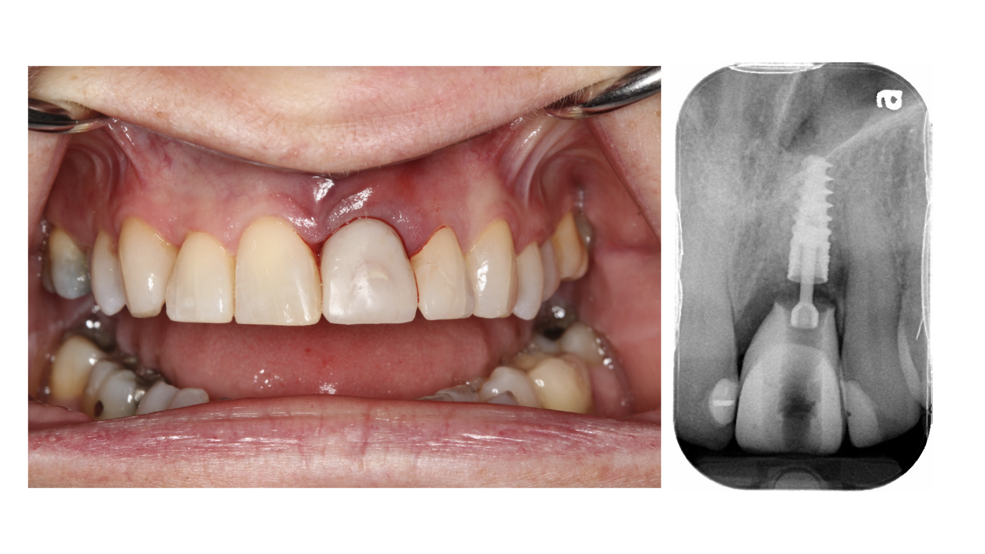 OH-Powell-main alternate text for this image