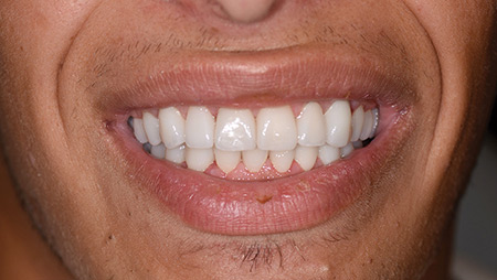 Aragon-8A-new alternate text for this image