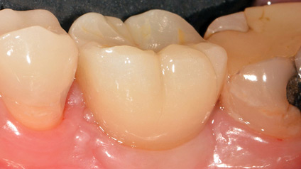 Birdi-FIG20 alternate text for this image