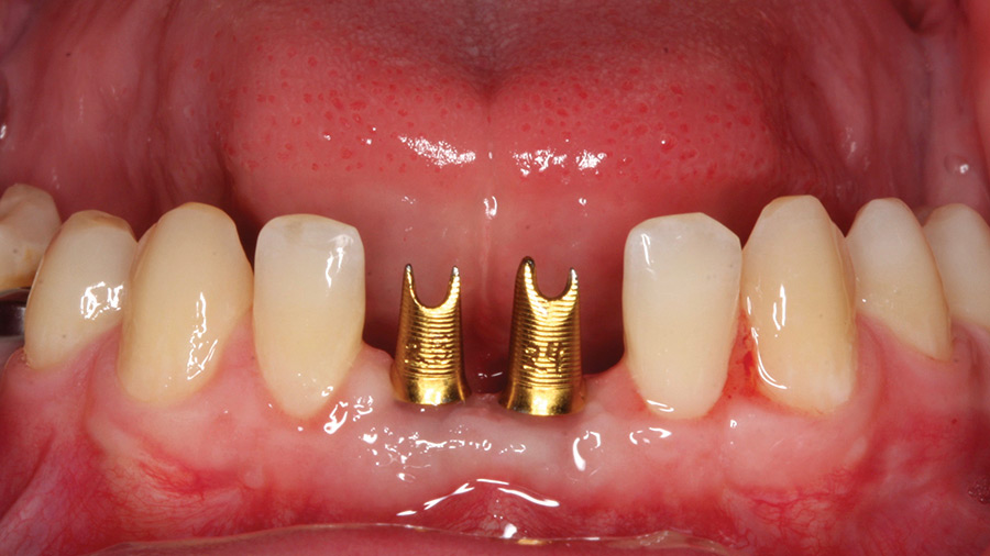 Chou-Figure-11athumbnail alternate text for this image