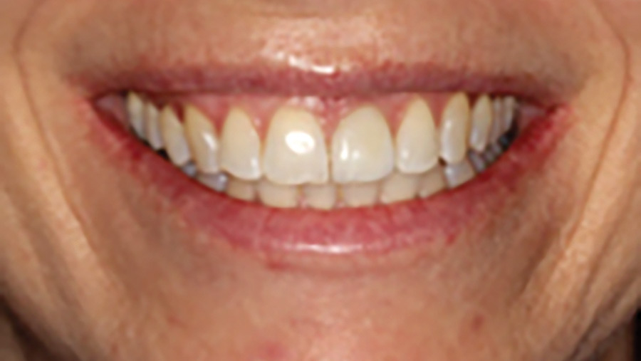 Zarb-fig-8THUMBNAIL alternate text for this image