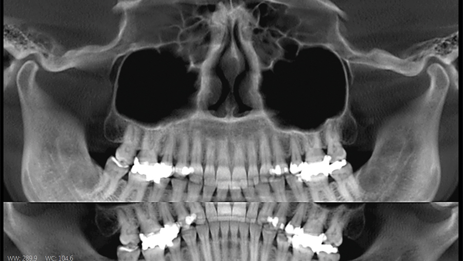 Dental Radiology