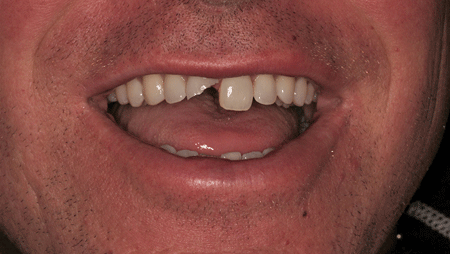 Lambert-Picture-1-thumbnail alternate text for this image