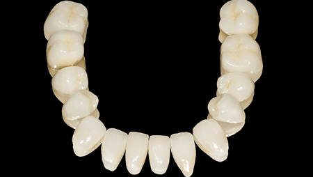 Full Mouth Rehabilitation