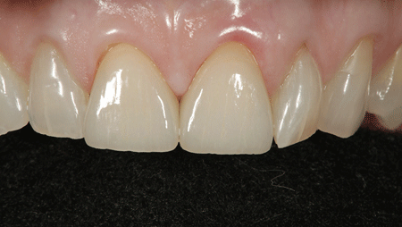 Lowe-015-thumbnail alternate text for this image