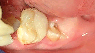 Roettger-Fig-thumbnail alternate text for this image