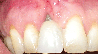 Rudick-Fig-27-thumbnail alternate text for this image