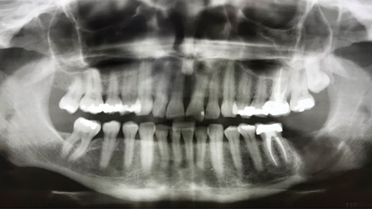 Klieb-fig-2-thumbnail alternate text for this image