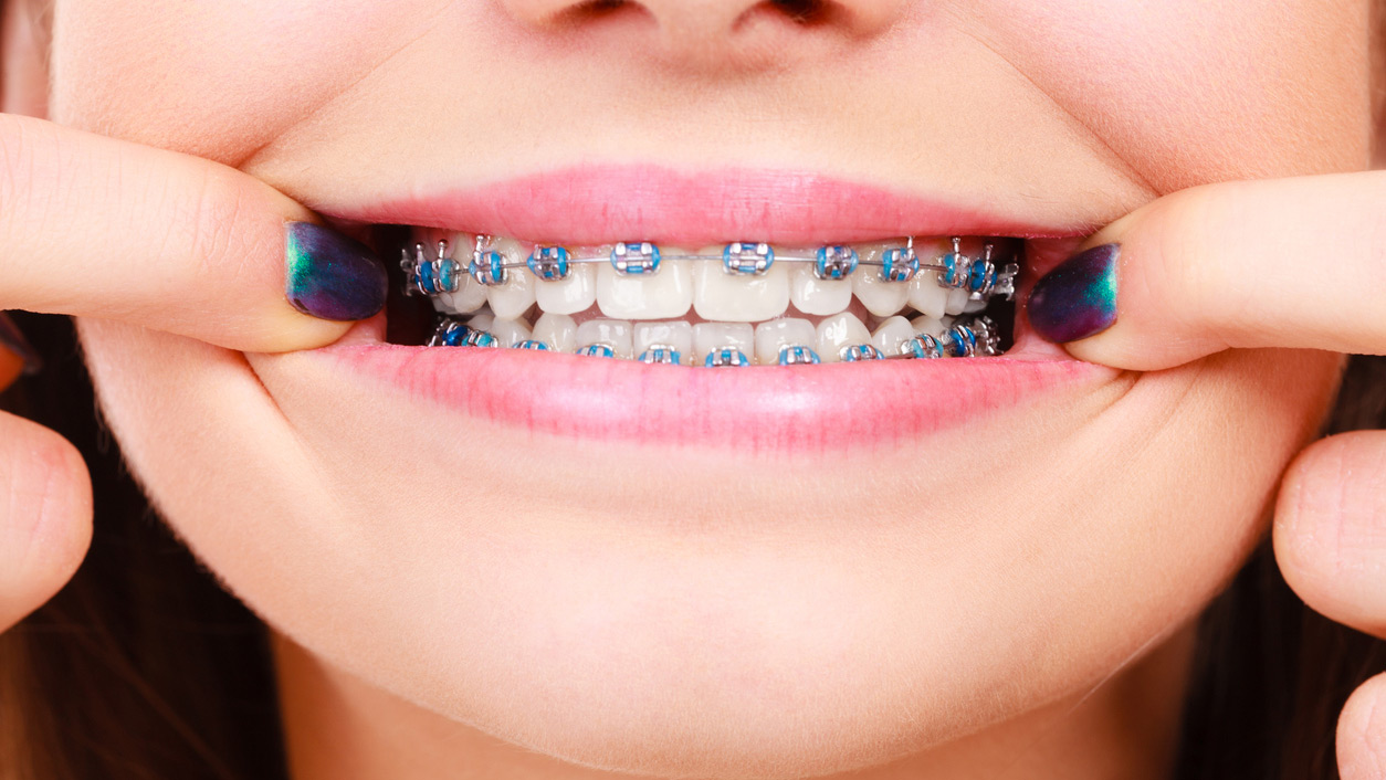National Orthodontic Health Month