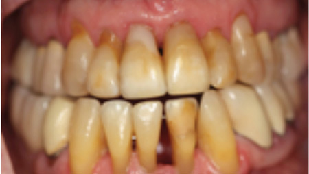 Belcastro-thumbnail alternate text for this image