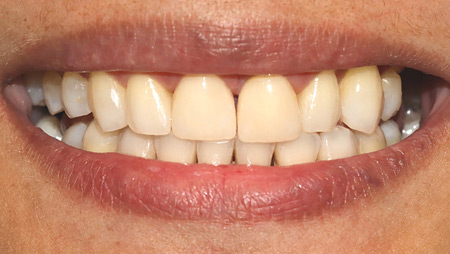 DSouza-case-thumbnail alternate text for this image