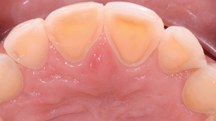 Rotella-thumbnail alternate text for this image