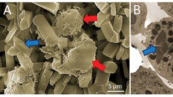 Immune Response to Implanted Bone Replacement Graft Materials