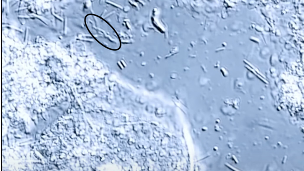 plaque-hygiene alternate text for this image