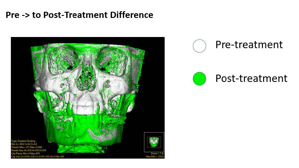 belfor-thumbnail alternate text for this image