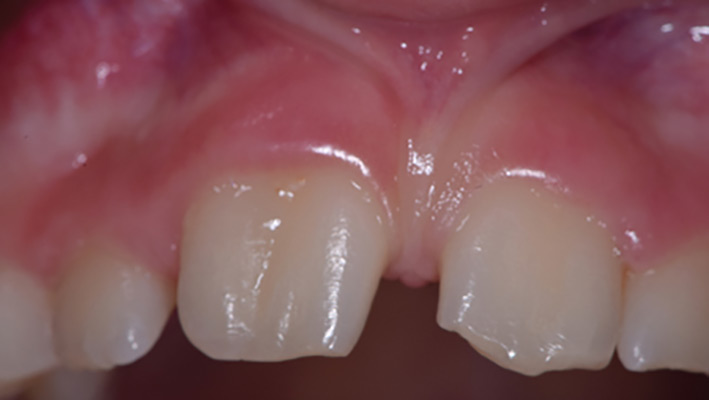 Cunha-Fig-5A alternate text for this image