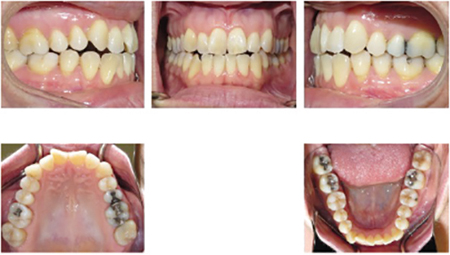 Chong fig 5 case 2 A-C alternate text for this image