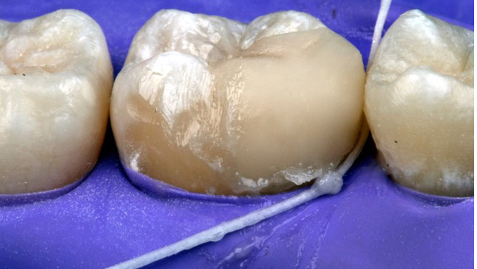 Lawson-fig1-thumbnail alternate text for this image