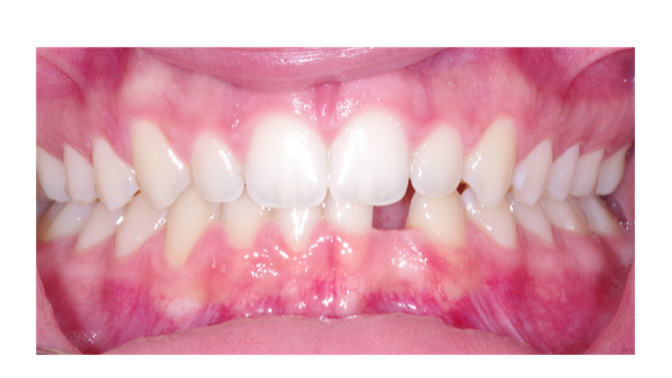 Prete-fig3-thumbnails alternate text for this image