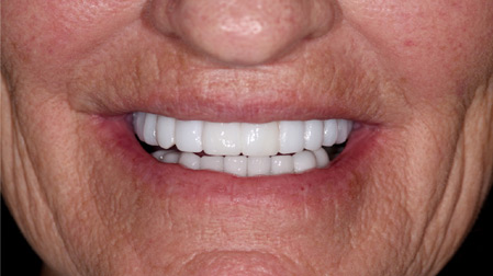 Aragon-case-5-fig-3-thumbnail alternate text for this image