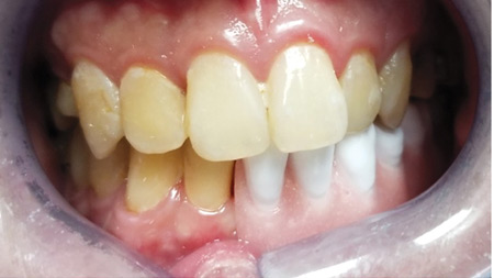 Leung-fig-20-thumbnail alternate text for this image