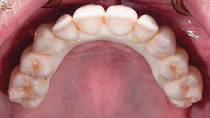 Pin-Fig_13-thumbnail alternate text for this image