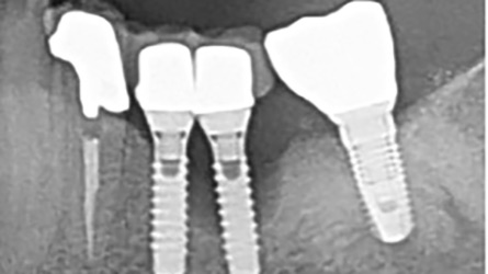 Suzuki-Fig-3-thumbnail alternate text for this image