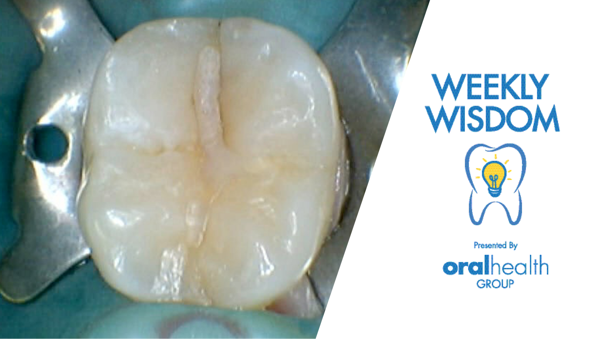 WW Thumbnail_1920x1080_191021 1 alternate text for this image