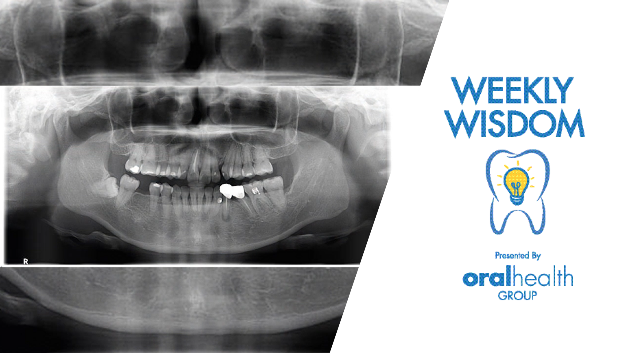 WW Thumbnail_1920x1080_150222 1 alternate text for this image