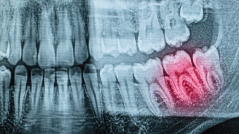 dentistry-is-broken-ohy alternate text for this image