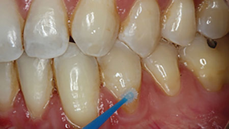 Lawson-FIG-3.1 alternate text for this image