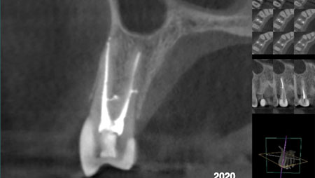 Serota-Fig-4E alternate text for this image