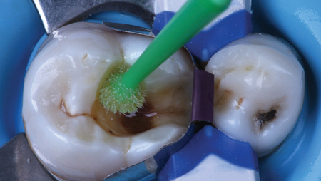 Mangla Figure 3.1 alternate text for this image