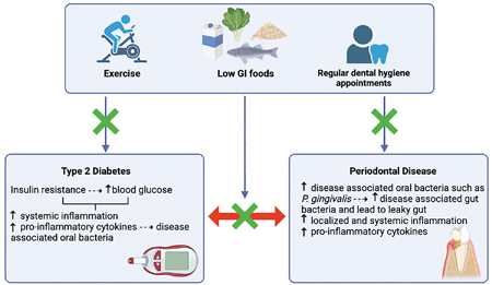 . Low GI foods, regular exercise and dental hygiene appointments can help manage both T2D and periodontal disease. Both T2D and periodontal disease result in an elevation of proinflammatory cytokines and altered oral and/or gut microbiome. T2D is characterized by an elevated level of blood glucose and insulin resistance which causes the liver to increase the production of pro-inflammatory cytokines that can travel and target periodontal tissue resulting in destruction of the periodontium and disease associated oral bacteria. P. gingivalis, an oral bacteria, causes periodontal disease which in turn further stimulates the production of this pathogen that can travel and target the liver resulting in T2D. Additionally, T2D can alter the oral microbiome and increase the number of pathogenic bacteria. Periodontal disease can also alter the oral and gut microbiome and increase disease-associated bacteria which alters metabolic activity and increases T2D risk. Note. GI = glycemic index; P. gingivalis = porphyromonas gingivalis. Diagram created with Biorender.