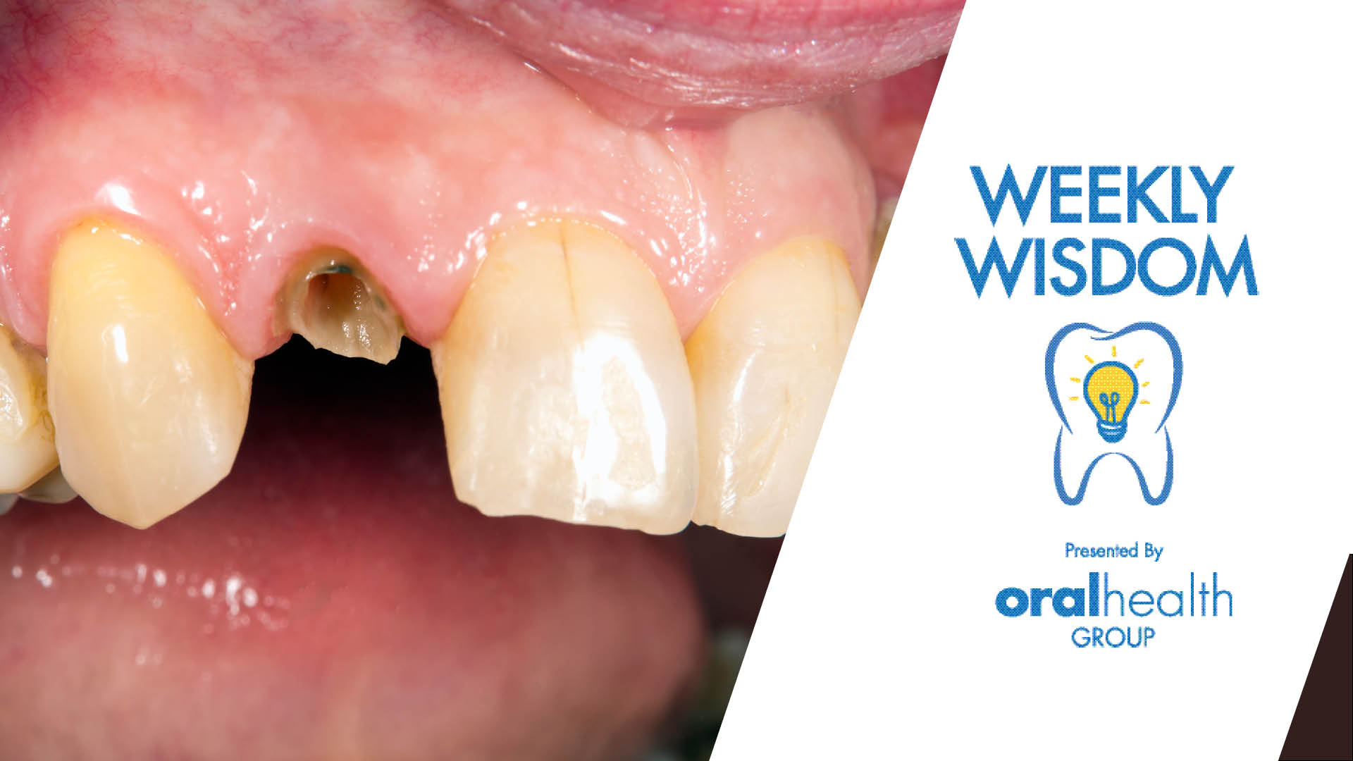 WW Thumbnail_1920x1080_060922 1 alternate text for this image