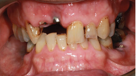 Leung Case 2 fig 1 alternate text for this image