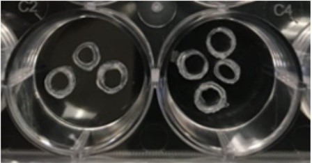 Novel hydrogel scaffolds developed by the UB researchers containing various concentrations of strontium. Photo: Michelle Visser.