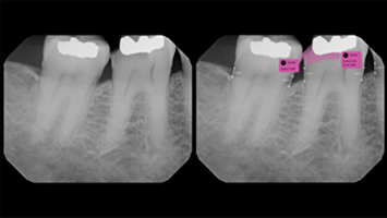 Roark thumbnail alternate text for this image